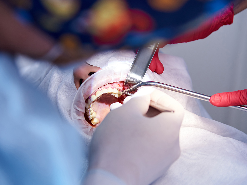 Amity Dentistry, Pineville, Implant Amity Dentistry, Pineville, Implant