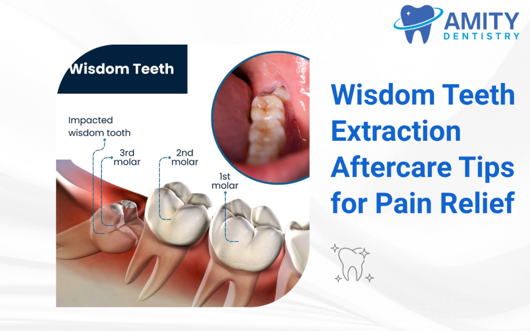 Wisdom Teeth