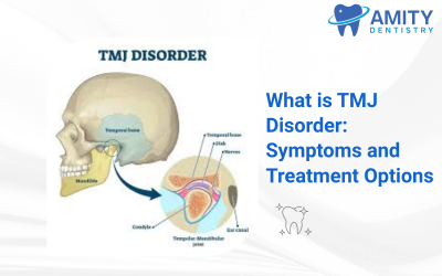 What is TMJ Disorder: Symptoms and Treatment Options