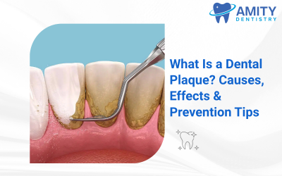 Gingivitis and Plaque: What’s Lurking in Your Smile?