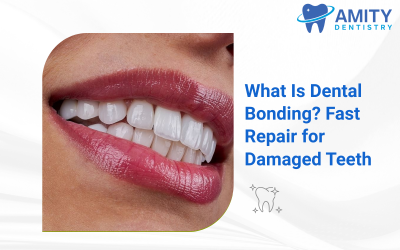 What Is Dental Bonding? Fast Repair for Damaged Teeth