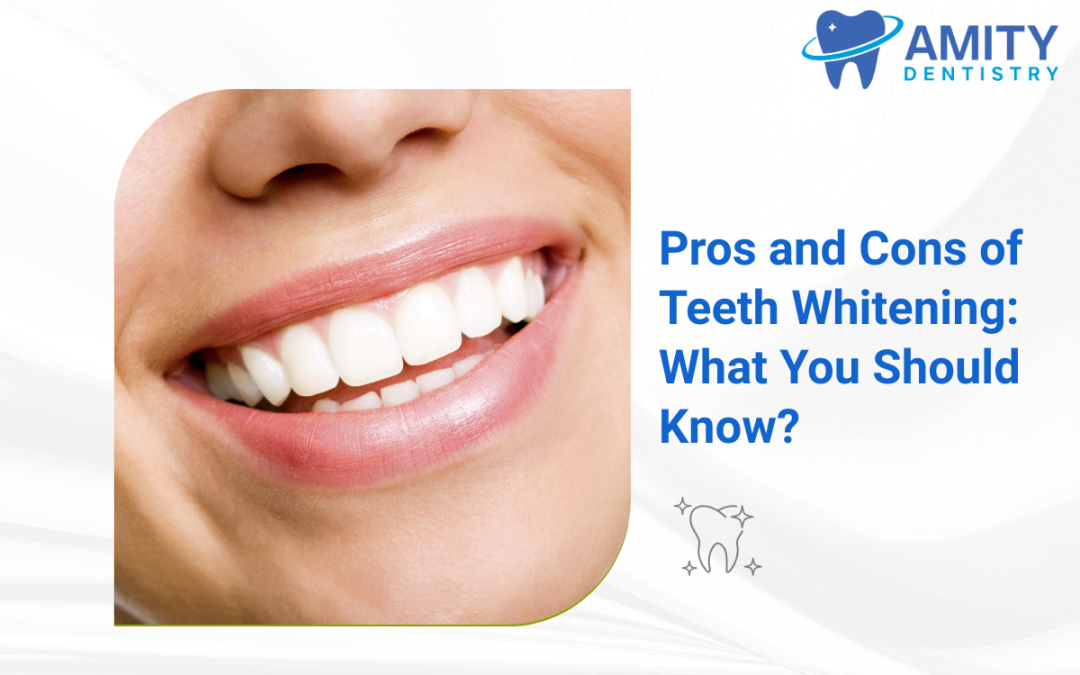 Pros and Cons of Teeth Whitening: What You Should Know?