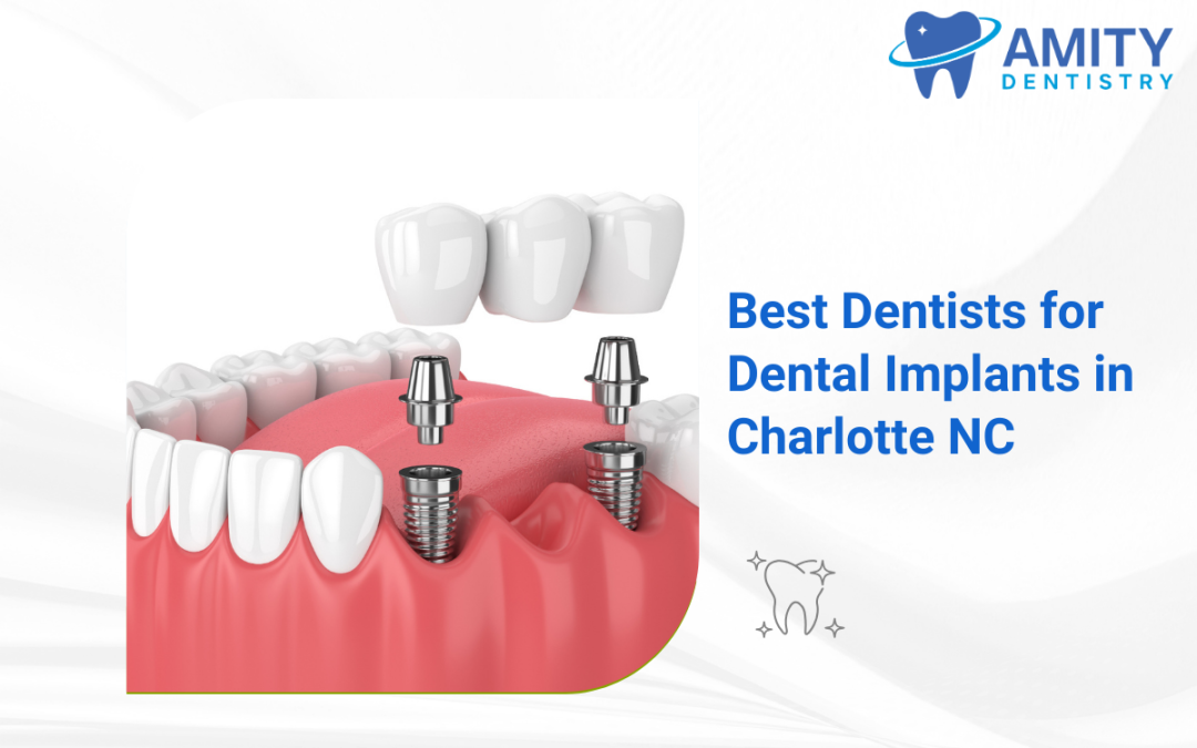 Best Dentists for Dental Implants in Charlotte NC