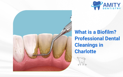 What is a Biofilm? Professional Dental Cleanings in Charlotte