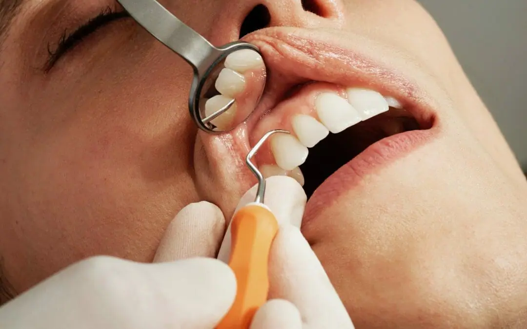Preventive Dentistry in Charlotte NC at Amity Dentistry