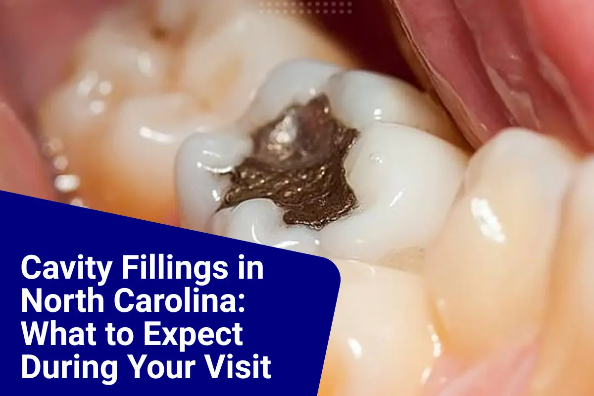 What Are Cavity Fillings? Care Tips by a Dentist at Amity Dentistry Pineville NC