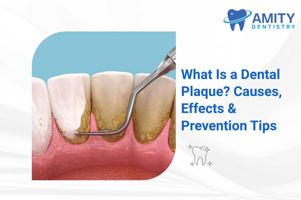 What Is a Dental Plaque? Causes & Effects | Prevention Tips by Amity Dentistry Pineville NC