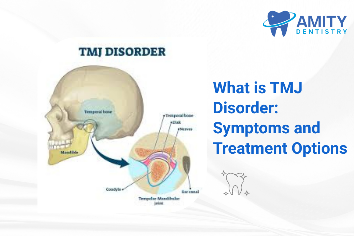 TMJ Disorder explained in a diagram