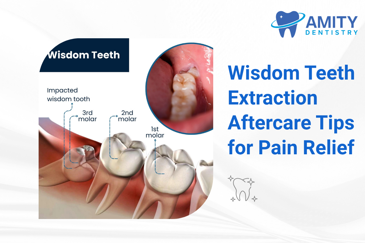 Wisdom Teeth Extraction in Pineville NC Aftercare Tips Guide by Amity Dentistry