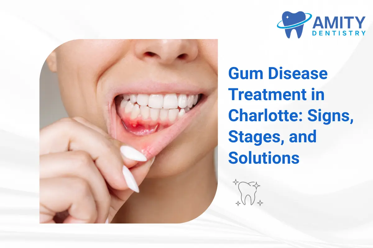 Gum Disease Treatment in Charlotte: Signs, Stages, and Solutions