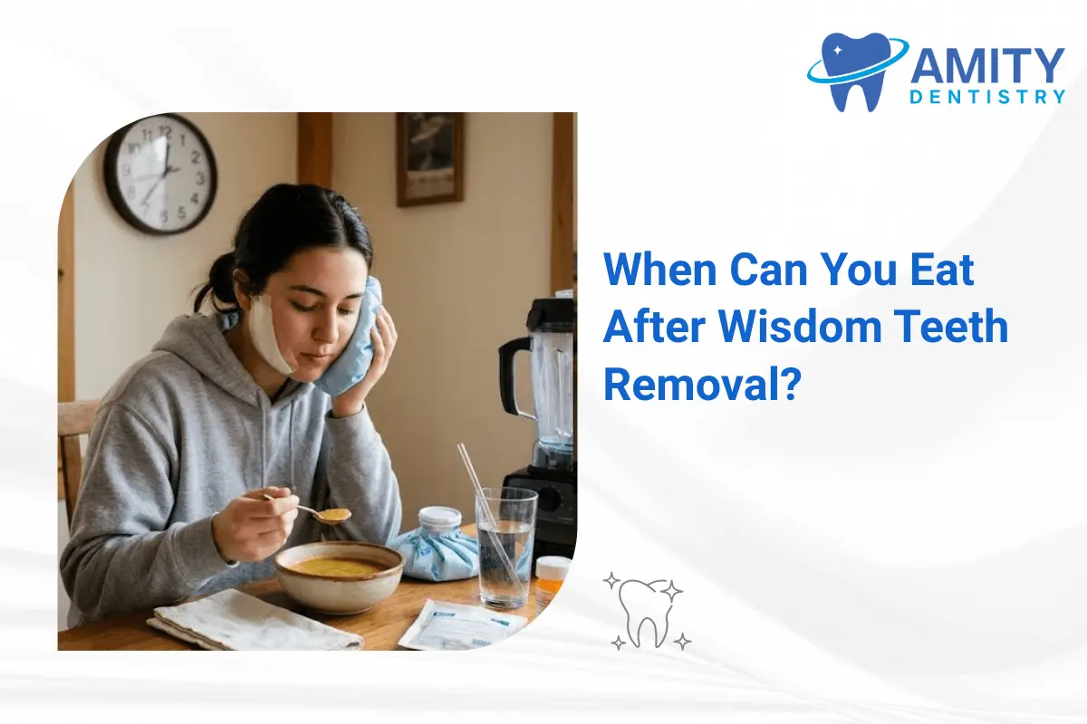 Knowing when can you eat after wisdom tooth removal is important and most situation calls for dentist recommendation as well